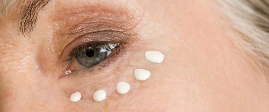 Surprising Foods That Could Be Causing Your Under-Eye Bags